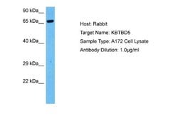 KBTBD5 Rabbit anti-Human, Polyclonal, Novus Biologicals 0.1ml; Unconjugated:Antibodies,